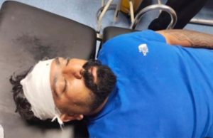 Kapurthala ‘ਚ ਪੁਰਾਣੀ ਰੰਜਿਸ਼ ਦੇ ਚਲਦਿਆਂ ਚੱਲੀਆਂ ਗੋਲੀਆਂ, ਸਰਪੰਚ ਦਾ ਪੁੱਤਰ ਜਖ਼ਮੀ