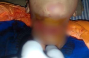 Jalandhar: China Dor ਨੇ ਇੱਕ ਹੋਰ ਵਿਅਕਤੀ ਨੂੰ ਬਣਾਇਆ ਸ਼ਿਕਾਰ, ਹਾਲਤ ਗੰਭੀਰ